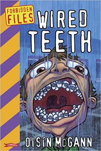 Wired Teeth Book Cover